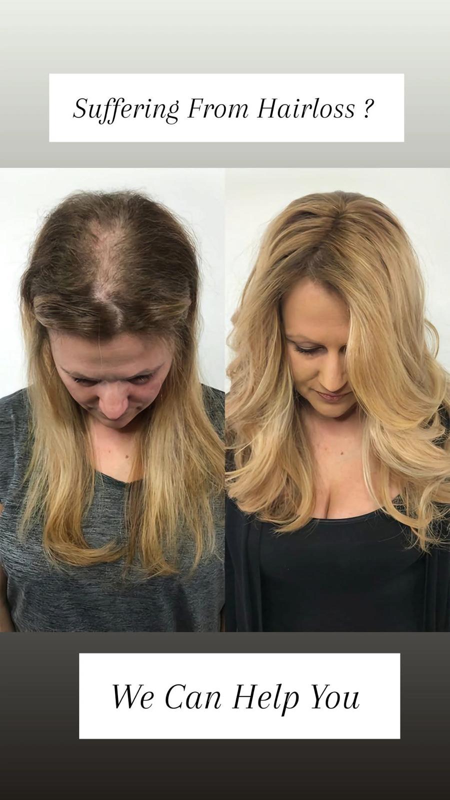 Hair transformation before and after